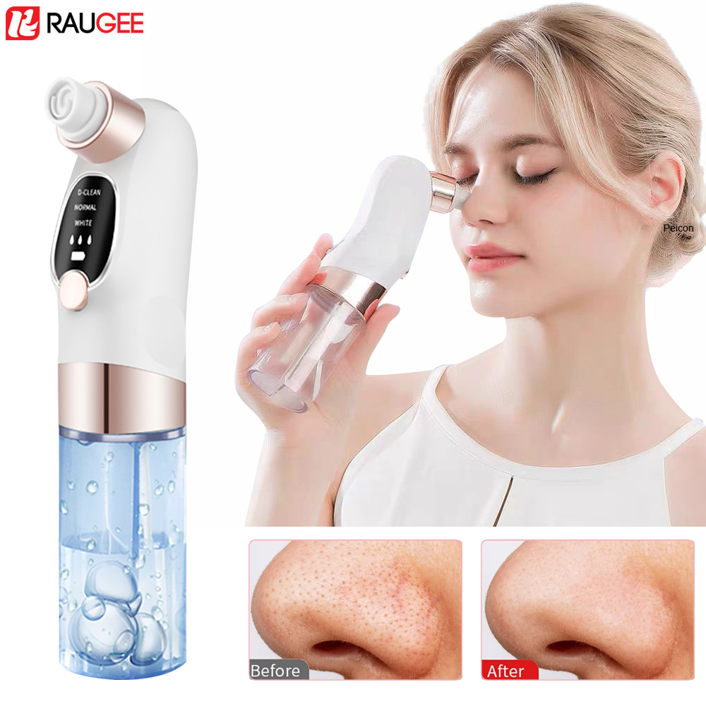 Estrattore di punti neri Estra - Air Bubble Remover recensione e prezzo